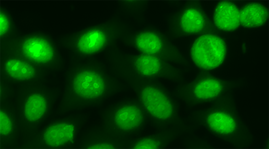 Clinical Immunology Laboratory
