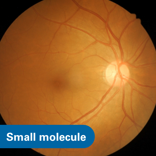 ETS Factors as Therapeutic Targets in Neovascular Eye Disease