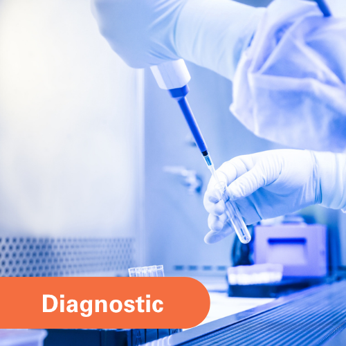 Anti-vimentin Antibody as a Biomarker for Sjögren’s Disease Severity