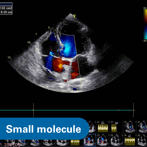 Thiol-reactive Compounds Attenuate Aortic Stenosis