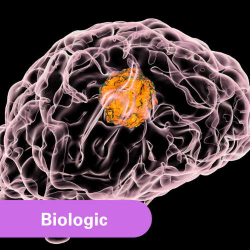 Monoclonal Antibody Therapy for Glioblastoma