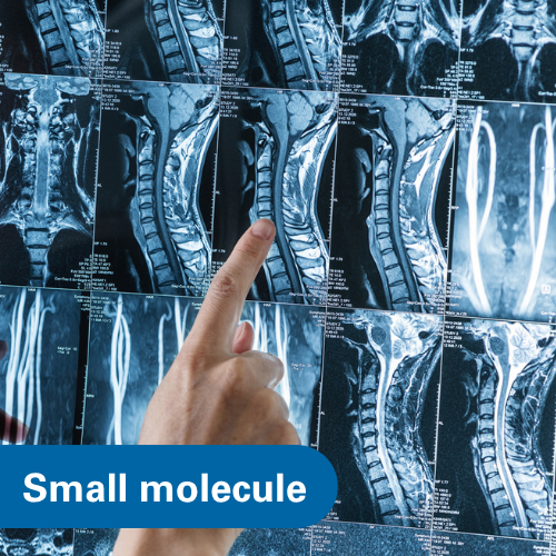 Treatment for a Rare Genetic Skeletal Dysplasia