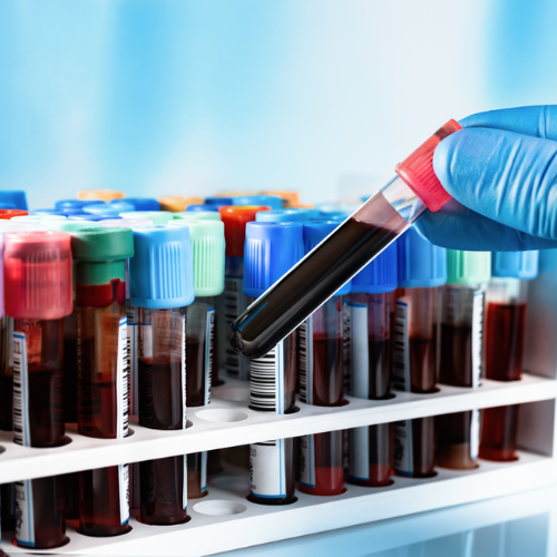 Prognostic Cytokine Biomarker Panel for Sarcoidosis