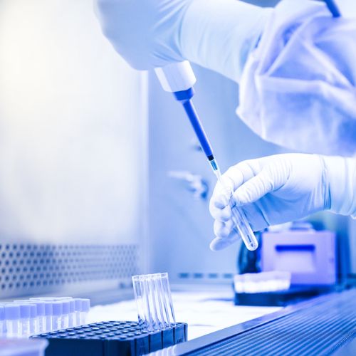 Anti-vimentin Antibody as a Biomarker for Sjögren’s Disease Severity