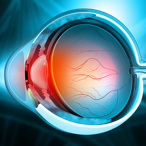 Blocking Retinal Capillary Regression to Prevent Retinopathy