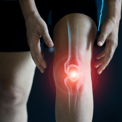 DNA Methylation Predicts Progression of Knee Osteoarthritis