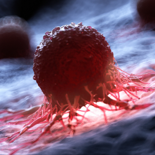 PFKFB2 Inhibitor as a Cancer Treatment
